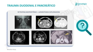 medvideos.com
Cópia não é roubo ♥
Renatha Paiva
TRAUMA DUODENAL E PANCREÁTICO
RETROPNEUMOPERITÔNIO = LAPAROTOMIA EXPLORADORA
medvideos.com
Cópia não é roubo ♥
 
