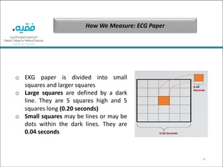 18
How We Measure: ECG Paper
o EKG paper is divided into small
squares and larger squares
o Large squares are defined by a dark
line. They are 5 squares high and 5
squares long (0.20 seconds)
o Small squares may be lines or may be
dots within the dark lines. They are
0.04 seconds
 
