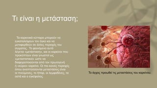 Τι είναι η μετάσταση;
• Τα καρκινικά κύτταρα μπορούν να
εγκαταλείψουν τον όγκο και να
μεταφερθούν σε άλλες περιοχές του
σώματος. Το φαινόμενο αυτό
λέγεται «μετάσταση», και οι καρκίνοι που
προκύπτουν είναι γνωστοί ως
«μεταστατικοί» ώστε να
διαφοροποιούνται από τον πρωτογενή
ή «κύριο» καρκίνο. Οι πιο κοινές περιοχές
όπου αναπτύσσονται μεταστάσεις είναι
οι πνεύμονες, το ήπαρ, οι λεμφαδένες, τα
οστά και ο εγκέφαλος.
Το άγχος προωθεί τις μεταστάσεις του καρκίνου.
 