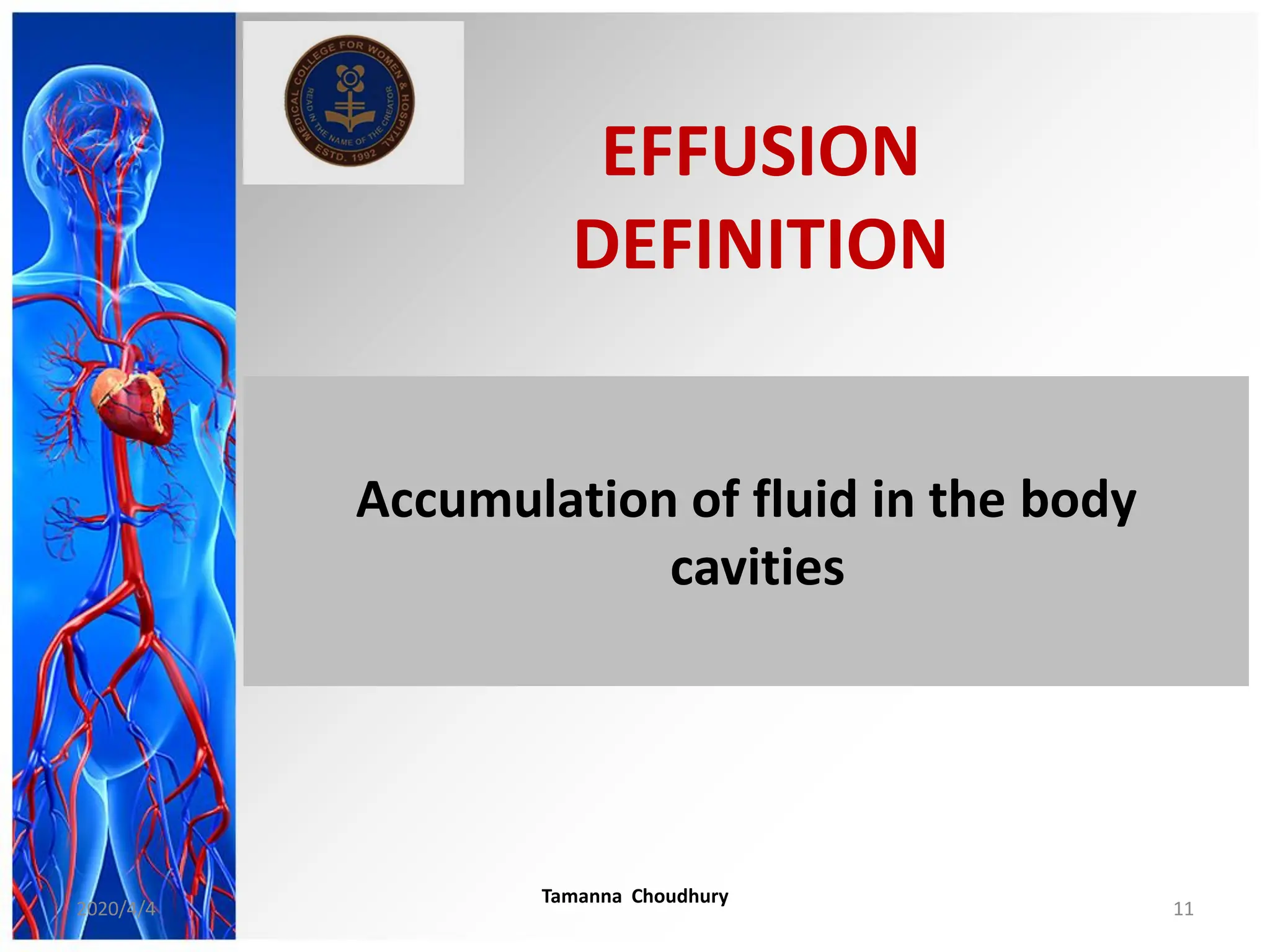 EFFUSION
DEFINITION
Accumulation of fluid in the body
cavities
2020/4/4
Tamanna Choudhury
11
 