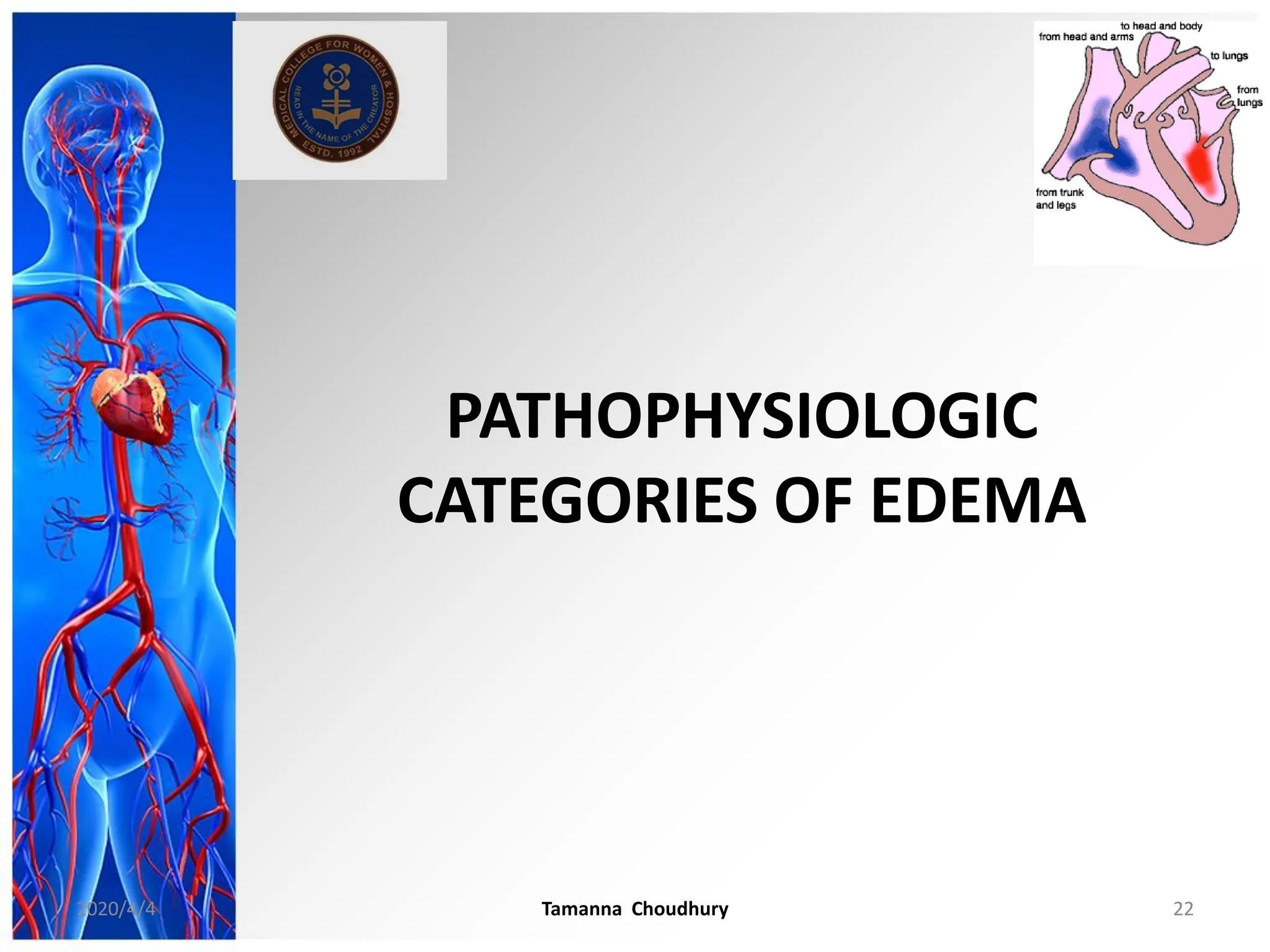 PATHOPHYSIOLOGIC
CATEGORIES OF EDEMA
2020/4/4 Tamanna Choudhury 22
 