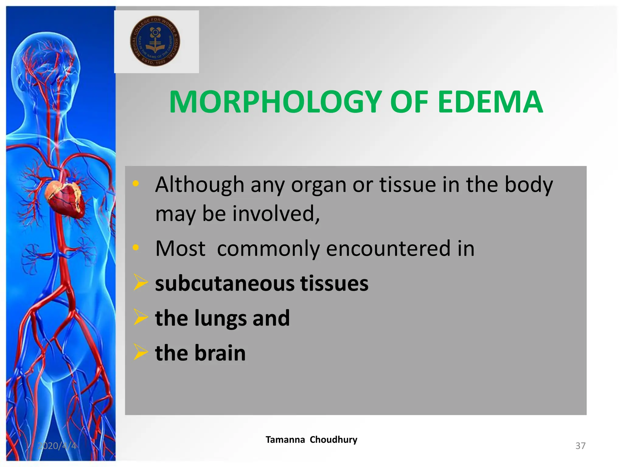 MORPHOLOGY OF EDEMA
• Although any organ or tissue in the body
may be involved,
• Most commonly encountered in
 subcutaneous tissues
 the lungs and
 the brain
2020/4/4
Tamanna Choudhury
37
 