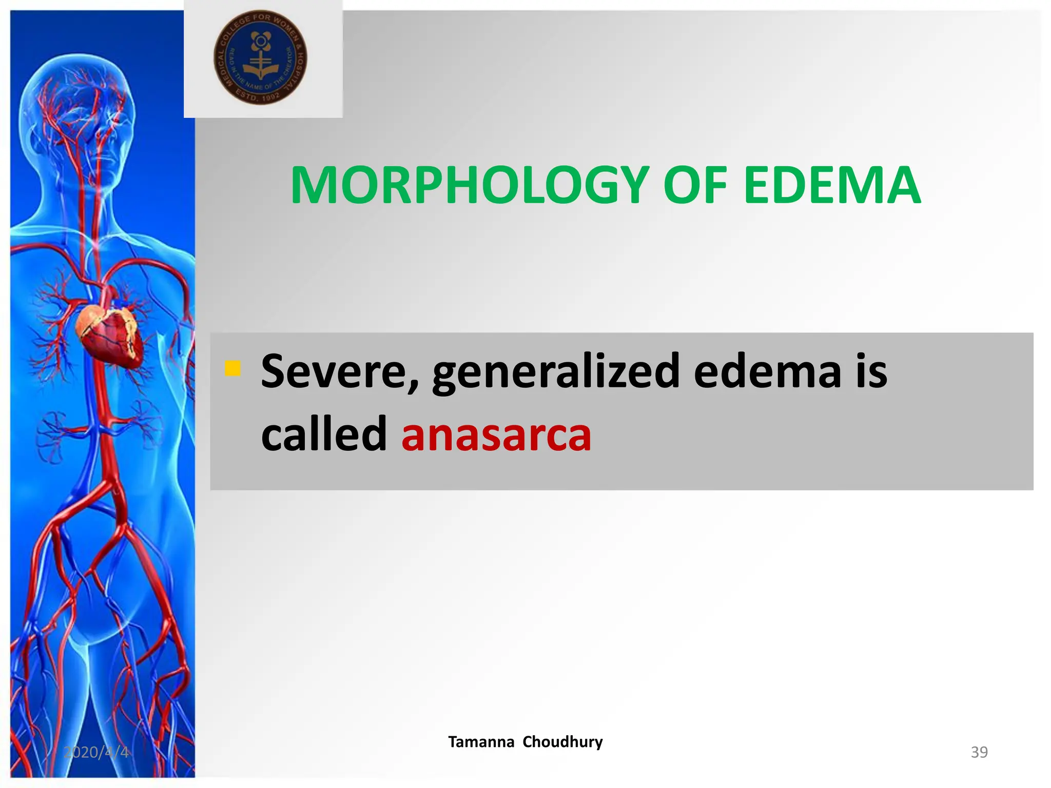  Severe, generalized edema is
called anasarca
MORPHOLOGY OF EDEMA
2020/4/4
Tamanna Choudhury
39
 