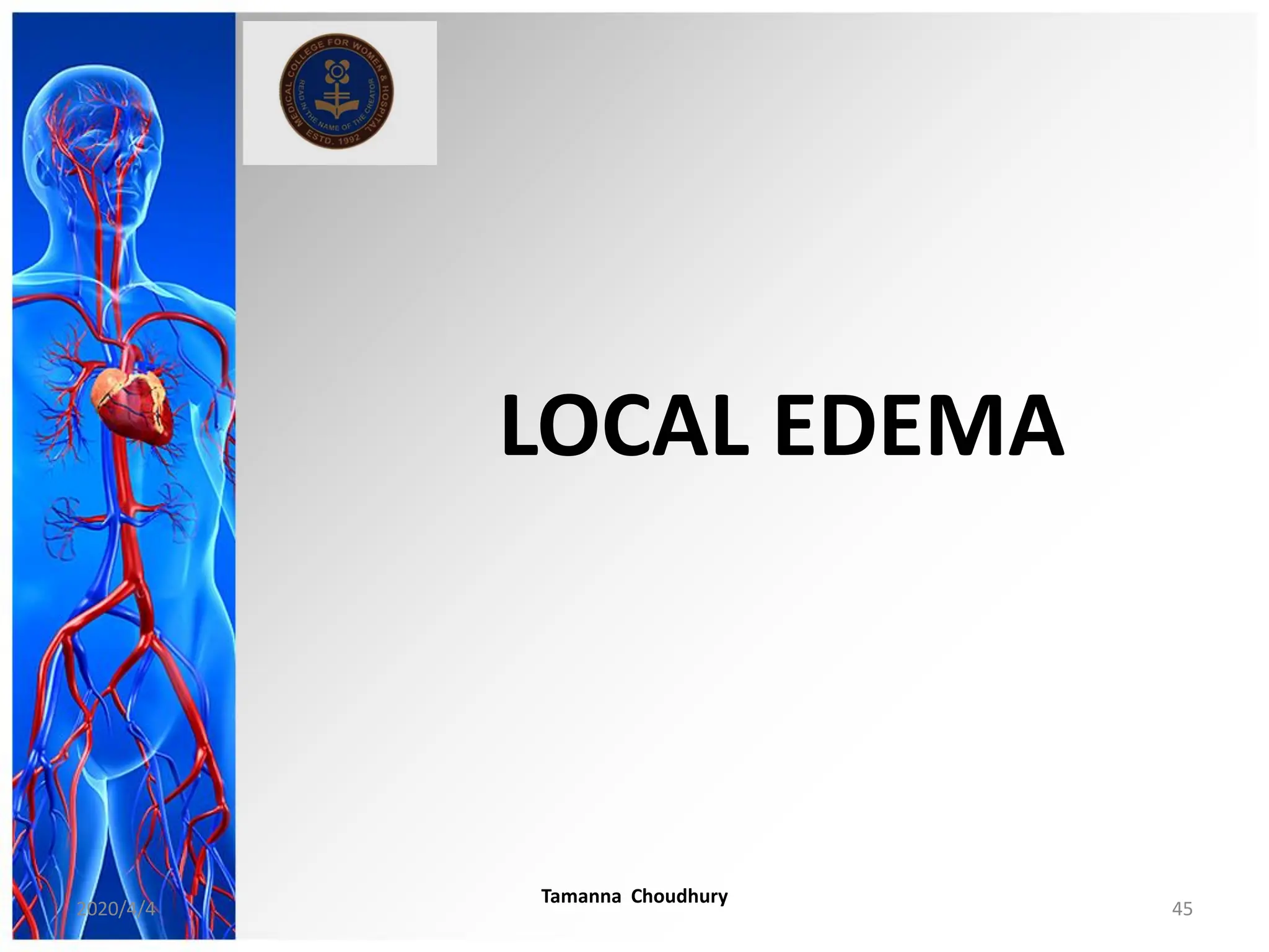 LOCAL EDEMA
2020/4/4
Tamanna Choudhury
45
 