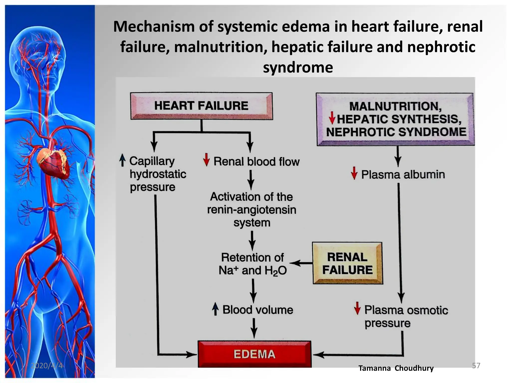 Mechanism of systemic edema in heart failure, renal
failure, malnutrition, hepatic failure and nephrotic
syndrome
2020/4/4 Tamanna Choudhury 57
 