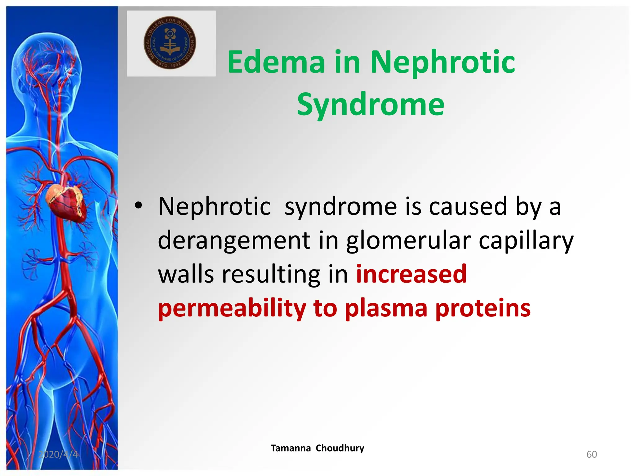 Edema in Nephrotic
Syndrome
• Nephrotic syndrome is caused by a
derangement in glomerular capillary
walls resulting in increased
permeability to plasma proteins
2020/4/4
Tamanna Choudhury
60
 
