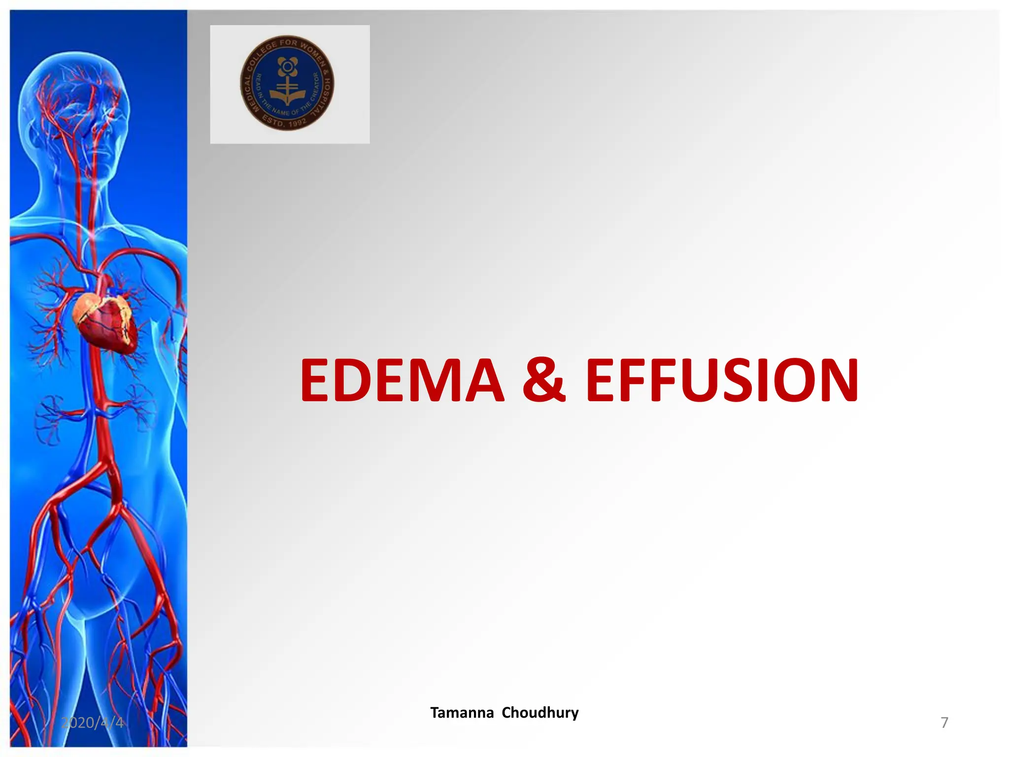 EDEMA & EFFUSION
2020/4/4
Tamanna Choudhury
7
 
