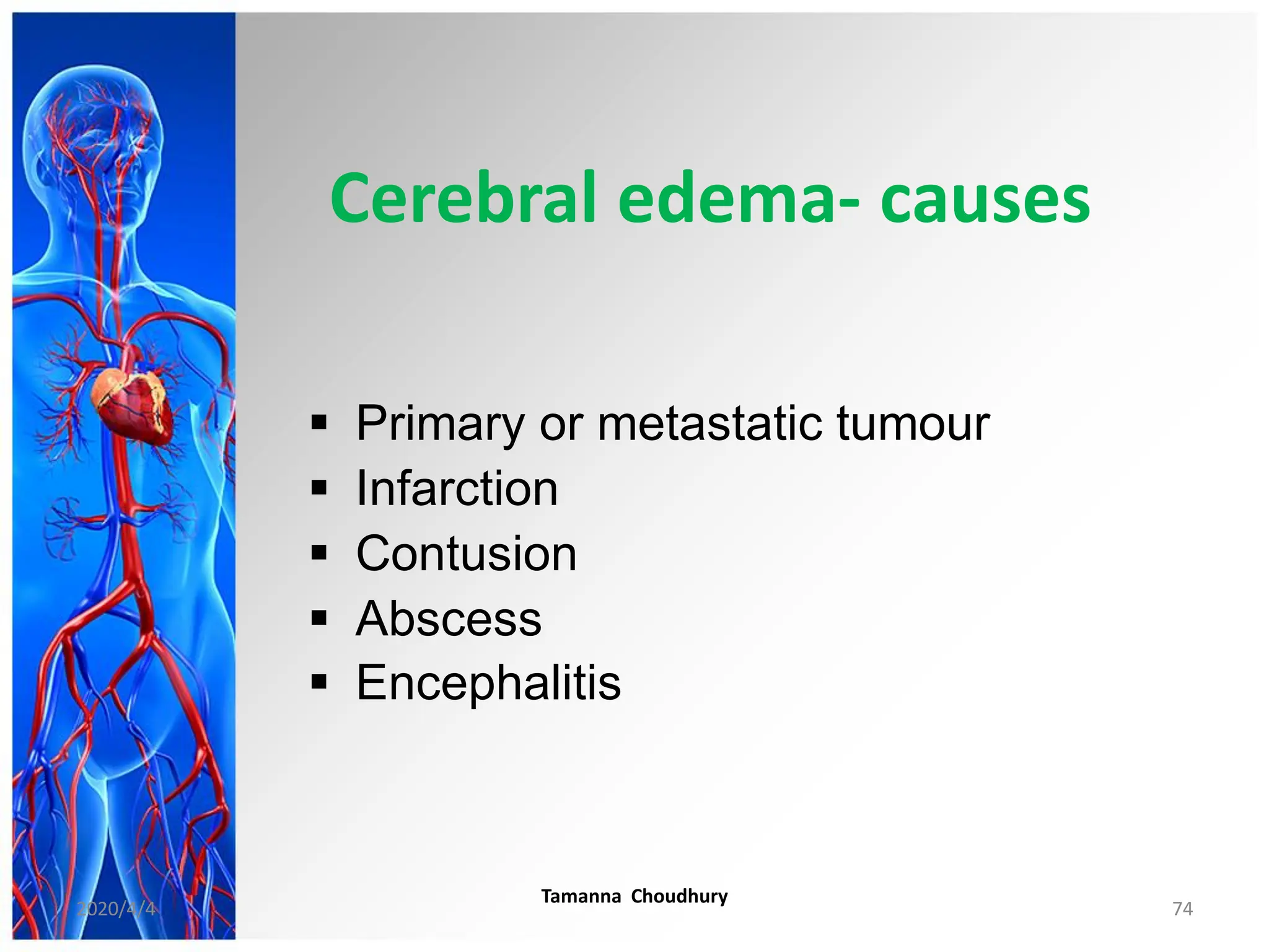 Cerebral edema- causes
 Primary or metastatic tumour
 Infarction
 Contusion
 Abscess
 Encephalitis
2020/4/4
Tamanna Choudhury
74
 