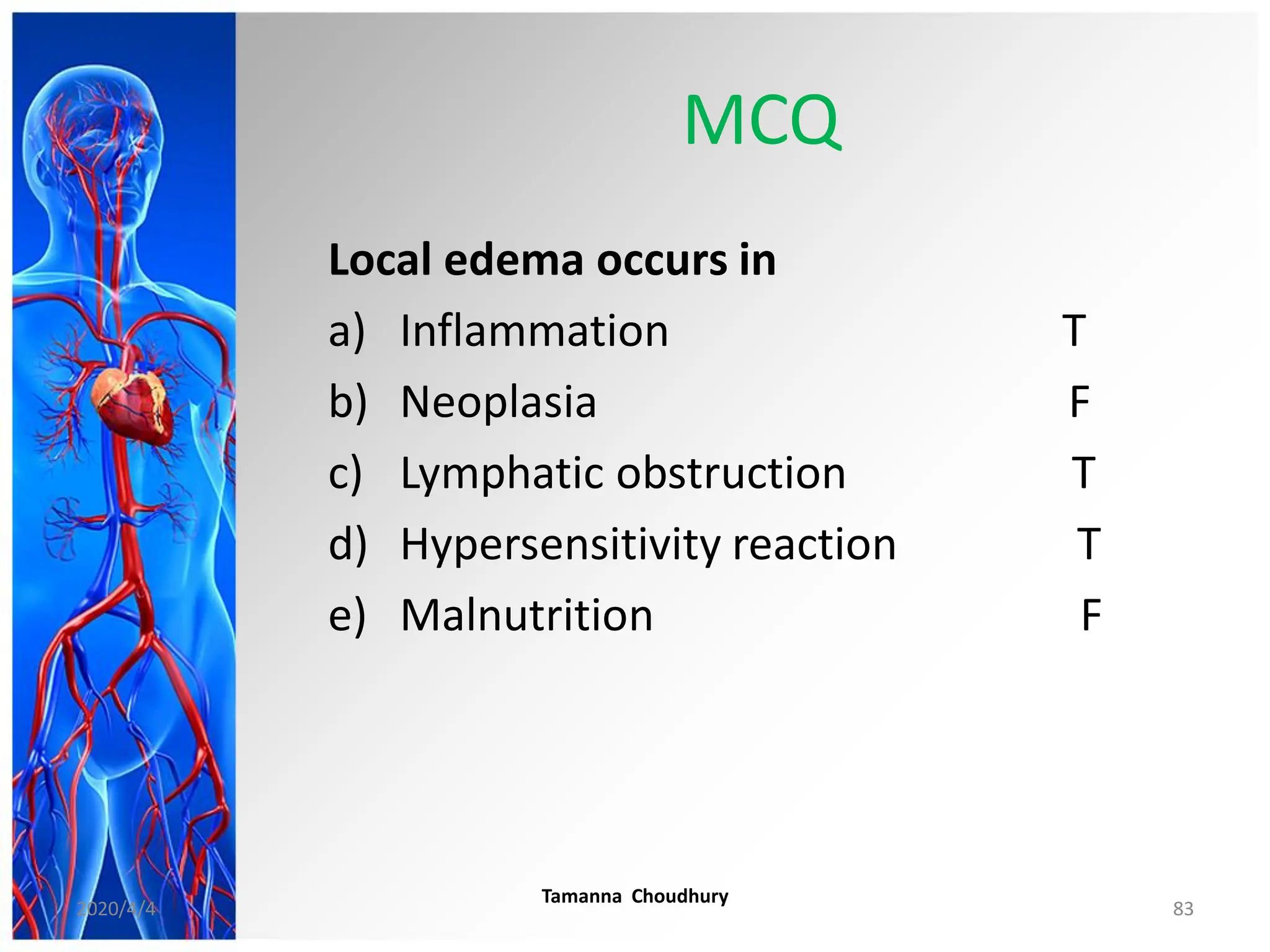MCQ
Local edema occurs in
a) Inflammation T
b) Neoplasia F
c) Lymphatic obstruction T
d) Hypersensitivity reaction T
e) Malnutrition F
2020/4/4
Tamanna Choudhury
83
 