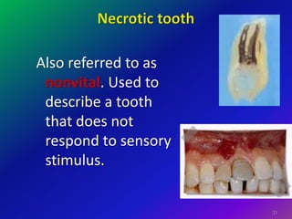 Stimulus Tooth 1. Introduction To Endodonticsss (1).pdf