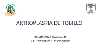 ARTROPLASTIA DE TOBILLO
DR. NELSON GUERRA ZABALETA
M.R. IV ORTOPEDIA Y TRAUMATOLOGIA
 