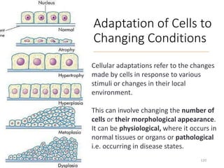 Adaptation of Cells to
Changing Conditions
Cellular adaptations refer to the changes
made by cells in response to various
stimuli or changes in their local
environment.
This can involve changing the number of
cells or their morphological appearance.
It can be physiological, where it occurs in
normal tissues or organs or pathological
i.e. occurring in disease states.
120
 
