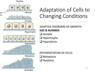 Adaptation of Cells to
Changing Conditions
ADAPTIVE DISORDERS OF GROWTH:
SIZE & NUMBER:
 Atrophy
 Hypertrophy
 Hyperplasia
DIFFERENTIATION OF CELLS:
 Metaplasia
 Dysplasia
122
 