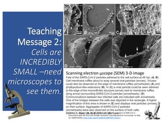 Teaching
Message 2:
Cells are
INCREDIBLY
SMALL –need
microscopes to
see them.
29
29
Scanning electron µscope (SEM) 3-D image
Fate of the SARS-CoV-2 particles adhered to the cell surface at 48 hpi. (A, B)
Cell membrane ruffles about to wrap several viral particles (arrows). Viruses
could also be observed on the edge of membrane ruffles (arrowheads) (A) and
phyllopodium-like extensions (B). In (C) a viral particle could be seen adhered
to the edge of the microvilli-like structure (arrow) next to membrane ruffles
(long arrow) surrounding SARS-CoV-2 particles (arrowheads). (D)
Communications between two infected cells are indicated with arrowheads.
One of the bridges between the cells was depicted in the rectangle. A higher
magnification of this area is shown in (E) and displays viral particles (arrows)
on their surface. Aggregates of SARS-CoV-2 particles
(arrowheads) were also observed on the surface of both cells.
MOI = 0.1; Bars: (A–C, E) 200 nm; (D) 1 µm.
Caldas, L.A., Carneiro, F.A., Higa, L.M. et al. Ultrastructural analysis of SARS-CoV-2
interactions with the host cell via high resolution scanning electron microscopy. Sci Rep
10, 16099 (2020). https://doi.org/10.1038/s41598-020-73162-5
 