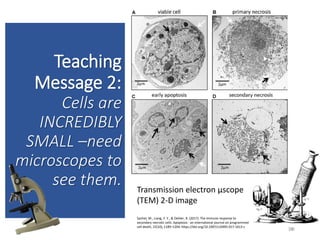 Teaching
Message 2:
Cells are
INCREDIBLY
SMALL –need
microscopes to
see them.
30
30
Transmission electron µscope
(TEM) 2-D image
Sachet, M., Liang, Y. Y., & Oehler, R. (2017). The immune response to
secondary necrotic cells. Apoptosis : an international journal on programmed
cell death, 22(10), 1189–1204. https://doi.org/10.1007/s10495-017-1413-z
 