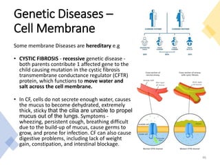 Genetic Diseases –
Cell Membrane
Some membrane Diseases are hereditary e.g
• CYSTIC FIBROSIS - recessive genetic disease -
both parents contribute 1 affected gene to the
child causing mutation in the cystic fibrosis
transmembrane conductance regulator (CFTR)
protein, which functions to move water and
salt across the cell membrane.
• In CF, cells do not secrete enough water, causes
the mucus to become dehydrated, extremely
thick, sticky that the cilia are unable to propel
mucus out of the lungs. Symptoms -
wheezing, persistent cough, breathing difficult
due to the build-up of mucus, cause germs to
grow, and prone for infection. CF can also cause
digestive problems, including lack of weight
gain, constipation, and intestinal blockage.
46
 