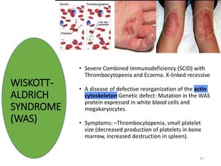 63
• Severe Combined Immunodeficiency (SCID) with
Thrombocytopenia and Eczema. X-linked recessive
• A disease of defective reorganization of the actin
cytoskeleton Genetic defect: Mutation in the WAS
protein expressed in white blood cells and
megakaryocytes.
• Symptoms: –Thrombocytopenia, small platelet
size (decreased production of platelets in bone
marrow, increased destruction in spleen).
WISKOTT-
ALDRICH
SYNDROME
(WAS)
 