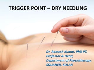 TRIGGER POINT – DRY NEEDLING
Dr. Ramesh Kumar. PhD PT.
Professor & Head,
Department of Physiotherapy,
SDUAHER, KOLAR
 