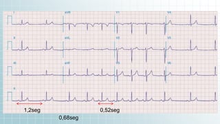 89,526,124$ 100%
That’s a lot of money
Total success!
185,244 users
And a lot of users
0,52seg
1,2seg
0,68seg
 