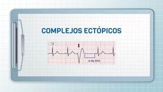 COMPLEJOS ECTÓPICOS
 