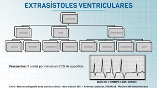 It’s the biggest planet in
the Solar System
EXTRASÍSTOLES VENTRICULARES
Chou’s Electrocardiografía en la práctica clínica. Sexta edición 2011 / Arritmias cardiacas, ITURRALDE , McGraw-Hill Interamericana
CLASIFICACIÓN
FRECUENCIA
AISLADAS FRECUENTES
FORMA
MONOMÓRFICAS POLIMÓRFICAS
COMPORTAMIENTO
BIGEMINADAS TRIGEMINADAS TETRAGEMINADAS DUPLAS
MÁS DE 3 COMPLEJOS: RITMO
Frecuentes: 5 o más por minuto en ECG de superficie
 