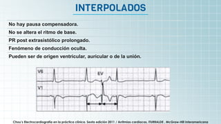 It’s the biggest planet in
the Solar System
INTERPOLADOS
Chou’s Electrocardiografía en la práctica clínica. Sexta edición 2011 / Arritmias cardiacas, ITURRALDE , McGraw-Hill Interamericana
No hay pausa compensadora.
No se altera el ritmo de base.
PR post extrasistólico prolongado.
Fenómeno de conducción oculta.
Pueden ser de origen ventricular, auricular o de la unión.
 