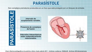 It’s the biggest planet in
the Solar System
PARASÍSTOLE
Chou’s Electrocardiografía en la práctica clínica. Sexta edición 2011 / Arritmias cardiacas, ITURRALDE , McGraw-Hill Interamericana
PARASÍSTOLE
Intervalo de
acoplamiento variable.
Presencia de complejos
de fusión
Intervalos interectópicos
están matemáticamente
relacionados.
Son complejos prematuros producidos en un foco que está protegido por un bloqueo de entrada.
 