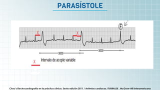 It’s the biggest planet in
the Solar System
PARASÍSTOLE
Chou’s Electrocardiografía en la práctica clínica. Sexta edición 2011 / Arritmias cardiacas, ITURRALDE , McGraw-Hill Interamericana
 
