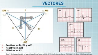 It’s the biggest planet in
the Solar System
VECTORES
 Positivas en DI, DII y aVF.
 Negativa en aVR
 Bifásicas en V1
Chou’s Electrocardiografía en la práctica clínica. Sexta edición 2011 / Arritmias cardiacas, ITURRALDE , McGraw-Hill Interamericana
 