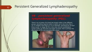 Persistent Generalized Lymphadenopathy
62
 