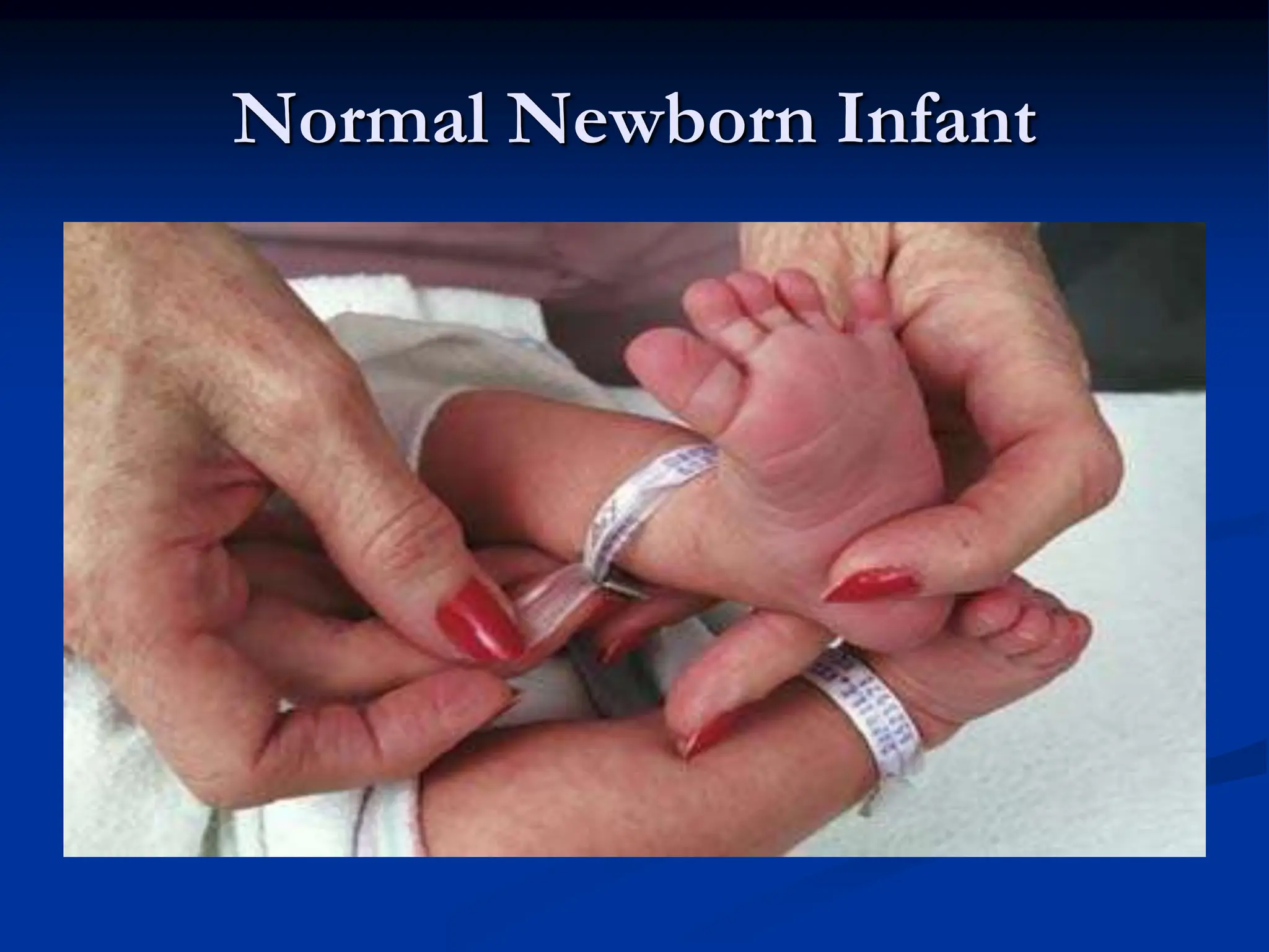 Normal Newborn Infant
 