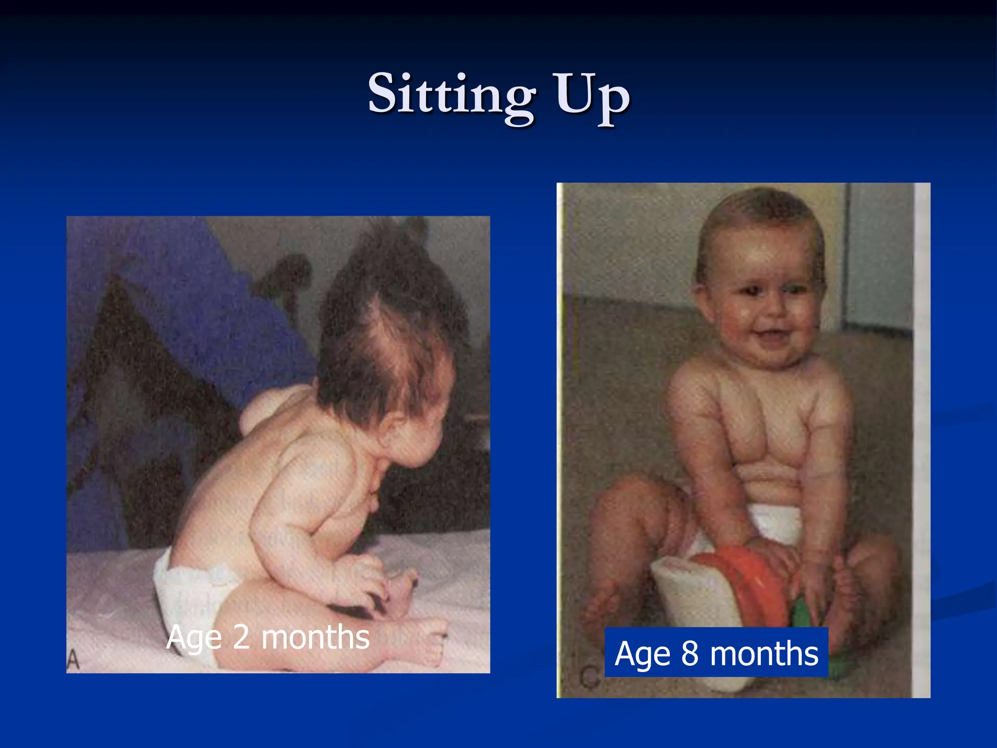 Sitting Up
Age 2 months
Age 8 months
 