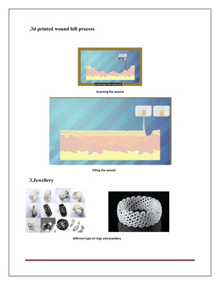 .3d printed wound hill process
Scanning the wound
3.Jewellery
Filling the wound
different type of rings and jewellery
 