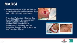 Marsi 1. Challenges in Neonatal Skin and Wound Care.pdf