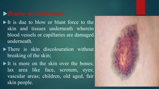 1. WOUND & WOUND HEALING III BHMS SURGERY.ppsx