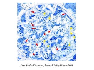 Gere Sunder-Plassmann, Textbook Fabry Disease 2006
 