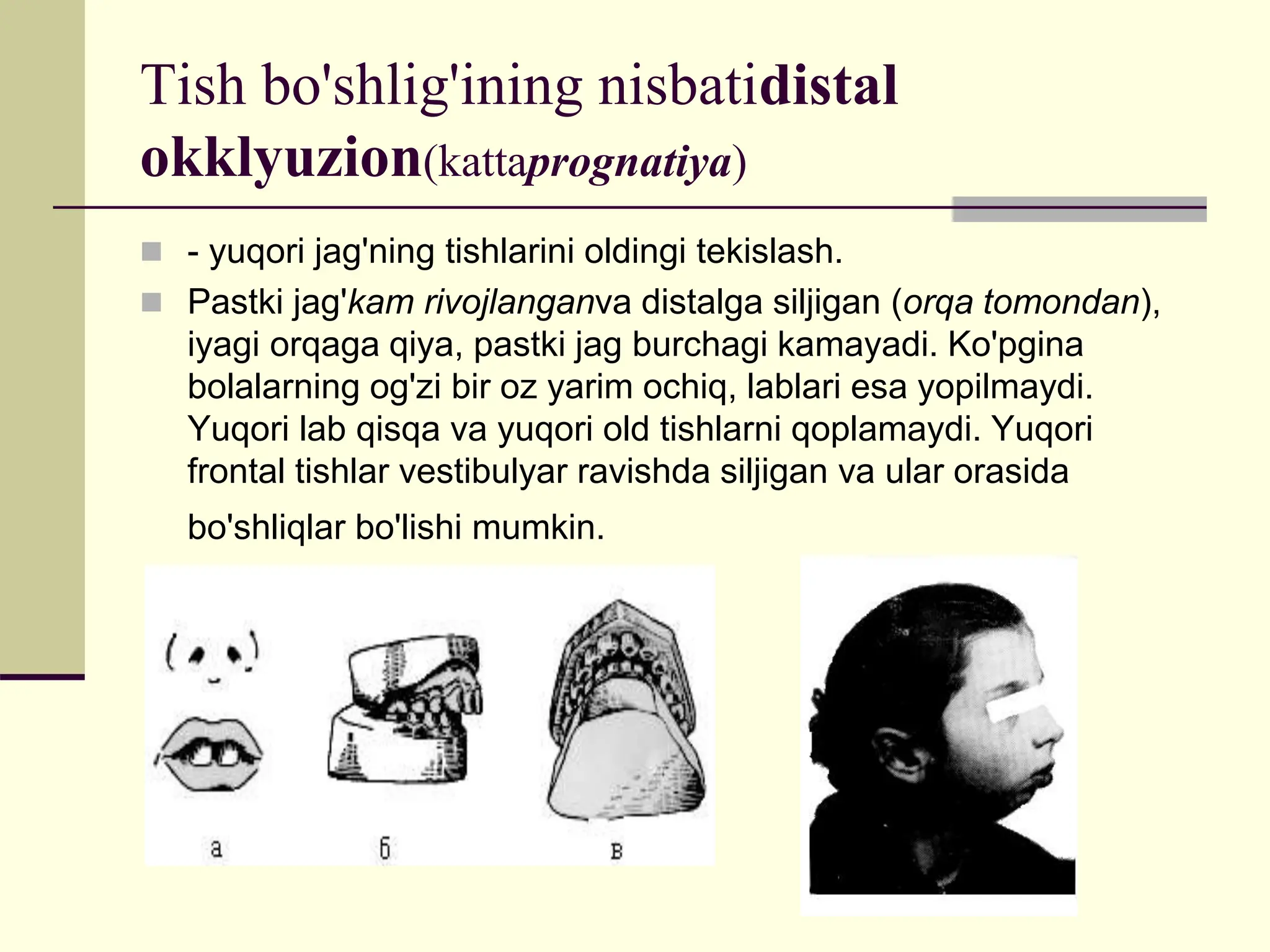 Onlayn porno uchun gozalliklar