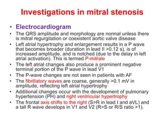 Investigations in mitral stenosis
• Electrocardiogram
• The QRS amplitude and morphology are normal unless there
is mitral regurgitation or coexistent aortic valve disease
• Left atrial hypertrophy and enlargement results in a P wave
that becomes broader (duration in lead II >0.12 s), is of
increased amplitude, and is notched (due to the delay in left
atrial activation). This is termed P-mitrale
• The left atrial changes also produce a prominent negative
terminal portion of the P wave in lead V1
• The P-wave changes are not seen in patients with AF
• The fibrillatory waves are coarse, generally >0.1 mV in
amplitude, reflecting left atrial hypertrophy
• Additional changes occur with the development of pulmonary
hypertension (PH) and right ventricular hypertrophy
• The frontal axis shifts to the right (S>R in lead I and aVL) and
a tall R wave develops in V1 and V2 (R>S or R/S ratio >1).
 