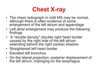 Chest X-ray
• The chest radiograph in mild MS may be normal,
although there is often evidence of some
enlargement of the left atrium and appendage
• Left atrial enlargement may produce the following
findings
• A "double density" (double right heart border
caused by the right side of the left atrium
extending behind the right cardiac shadow
• Straightened left heart border
• Elevated left bronchus
• On the lateral projection, posterior displacement of
the left atrium, impinging on the esophagus
 