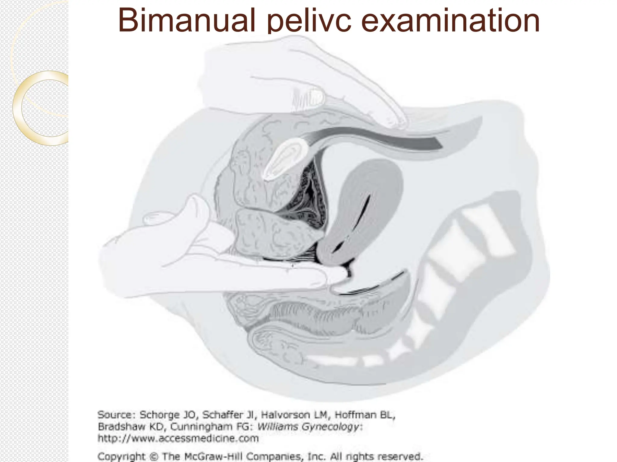 Bimanual pelivc examination
 