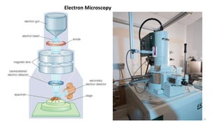 12
Electron Microscopy
 