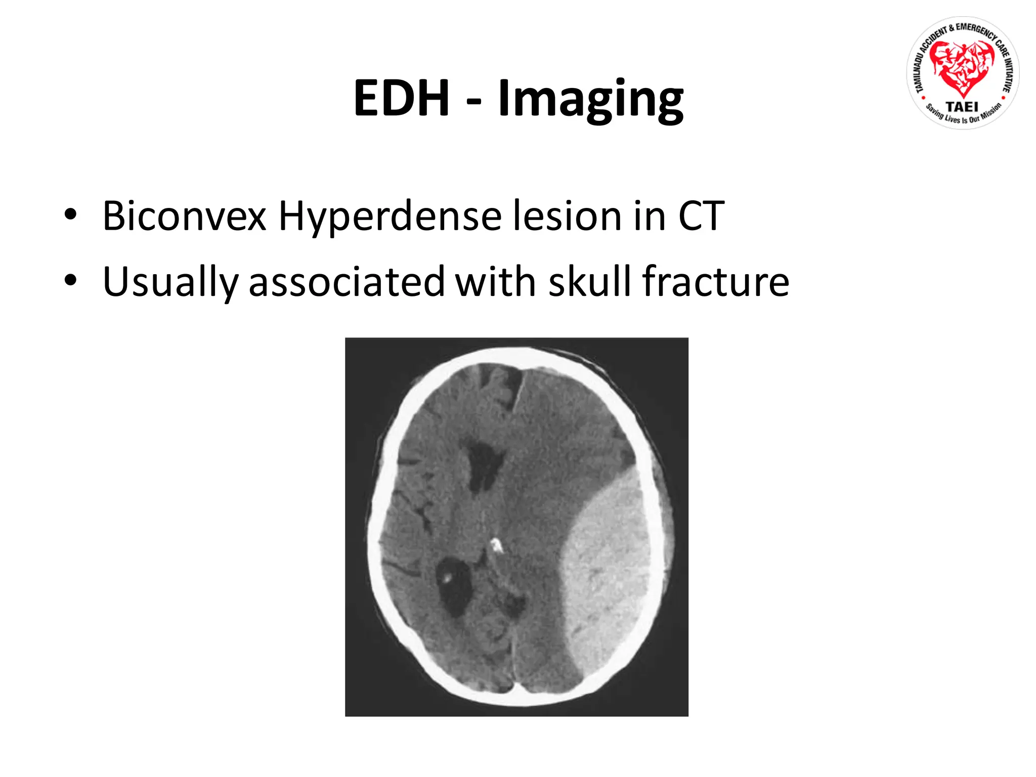 Psychiatry Traumatic Brain Injury Ppt Ppt Ppt