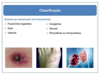 Quanto ao mecanismo de transmissão:
➢ Fecal-Oral (ingestão);
➢ Oral;
➢ Vetorial;
Classificação
➢ Congênita;
➢ Sexual;
➢ Percutânea ou transcutânea.
 