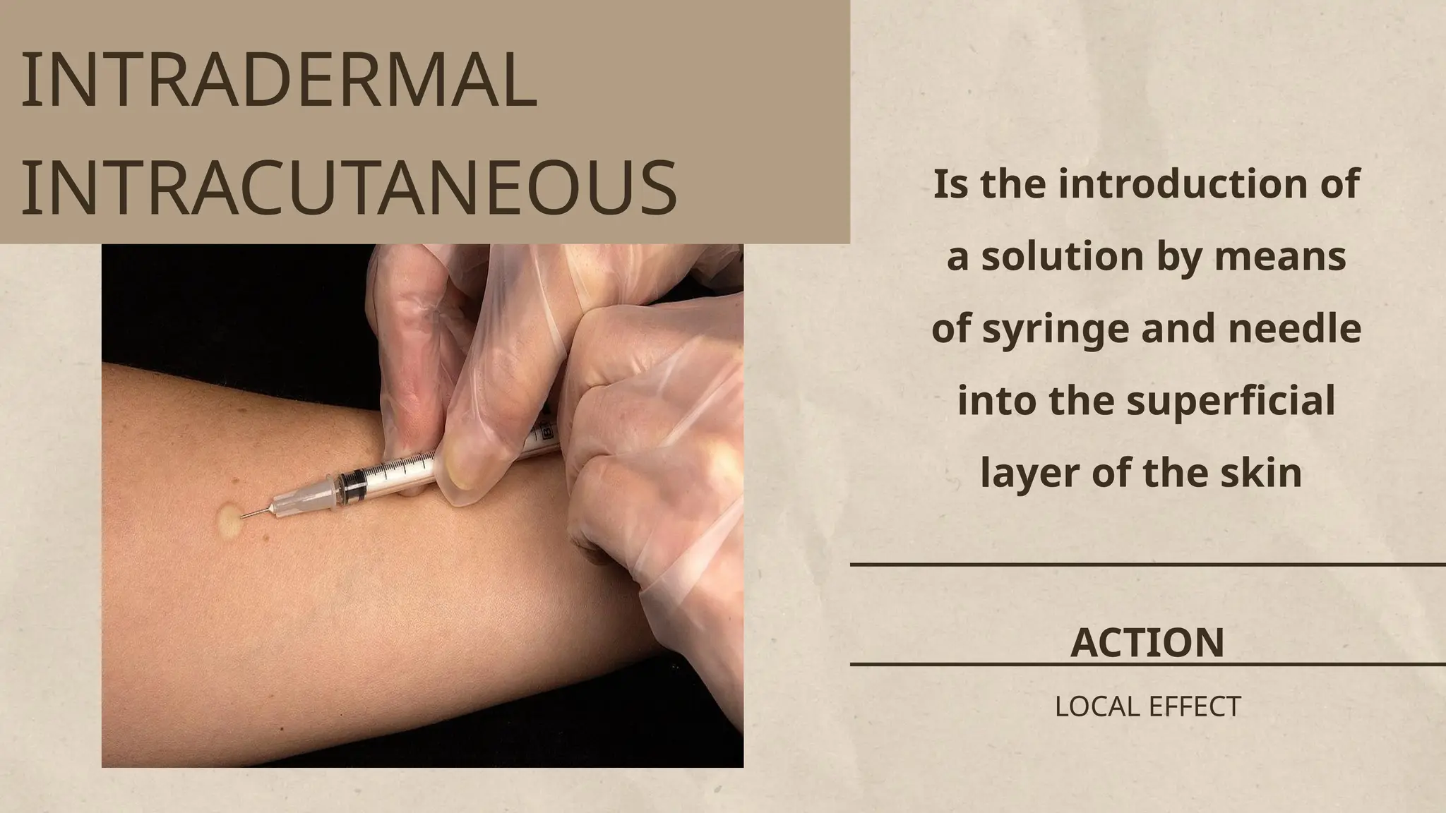 Is the introduction of
a solution by means
of syringe and needle
into the superficial
layer of the skin
ACTION
LOCAL EFFECT
INTRADERMAL
INTRACUTANEOUS
 