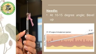 Needle:
• At 10-15 degree angle; Bevel
up
 