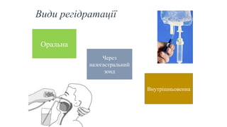 Види регідратації
Оральна
Через
назогастральний
зонд
Внутрішньовенна
 