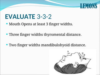 1.AIRWAY ASSESSMENT LOOK, LISTEN, FEEL: Mallampati, LEMON, neck ...