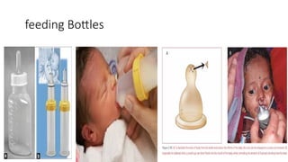1. Cleft lip and palate surgery 2021.pptx