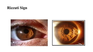 Rizzuti Sign
 