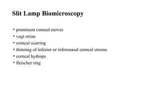 Slit Lamp Biomicroscopy
• prominent corneal nerves
• vogt striae
• corneal scarring
• thinning of inferior or inferonasal corneal stroma
• corneal hydrops
• fleischer ring
 